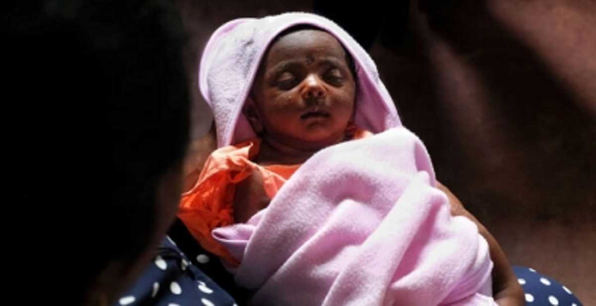 श्रीलंका में 40 हजार बच्चे आने वाले महीनों में कुपोषण से हो सकते हैं पीड़ित