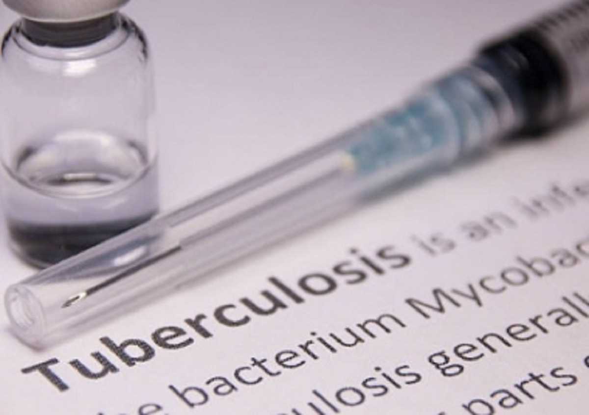 यूपी : टीबी मामलों की पहचान के लिए योगी सरकार ने शुरु किया अभियान