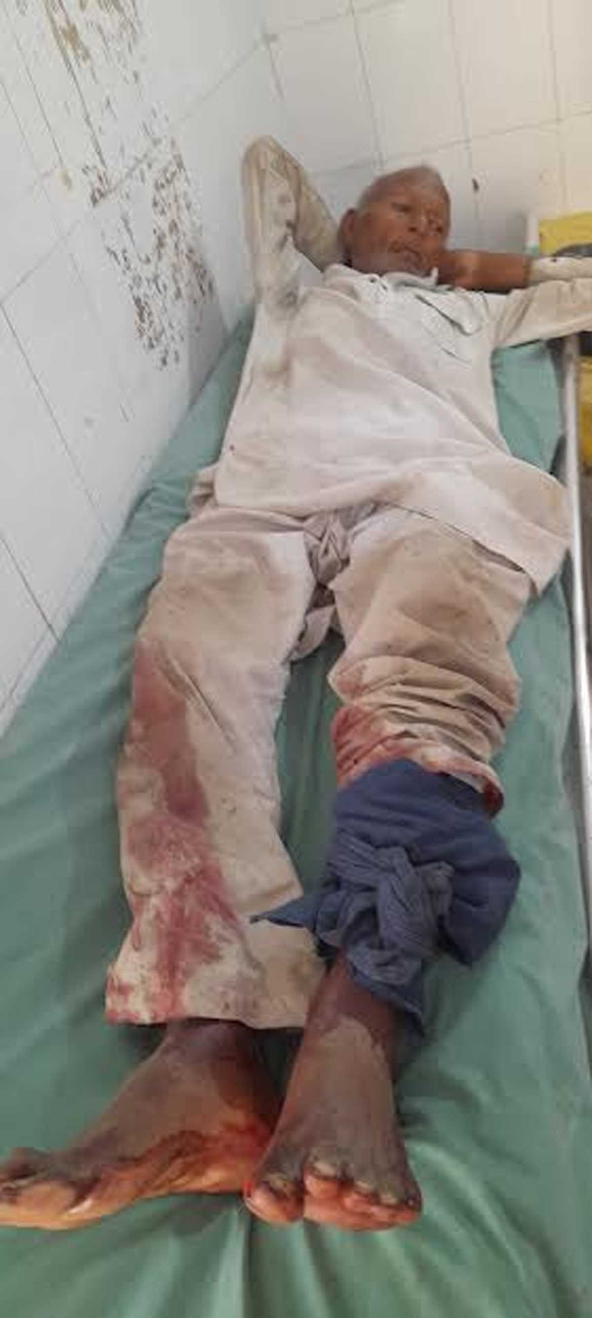 जमीन के विवाद में दो पक्षों में हुआ खूनी संघर्ष, बुजुर्ग को गोली मारकर किया घायल