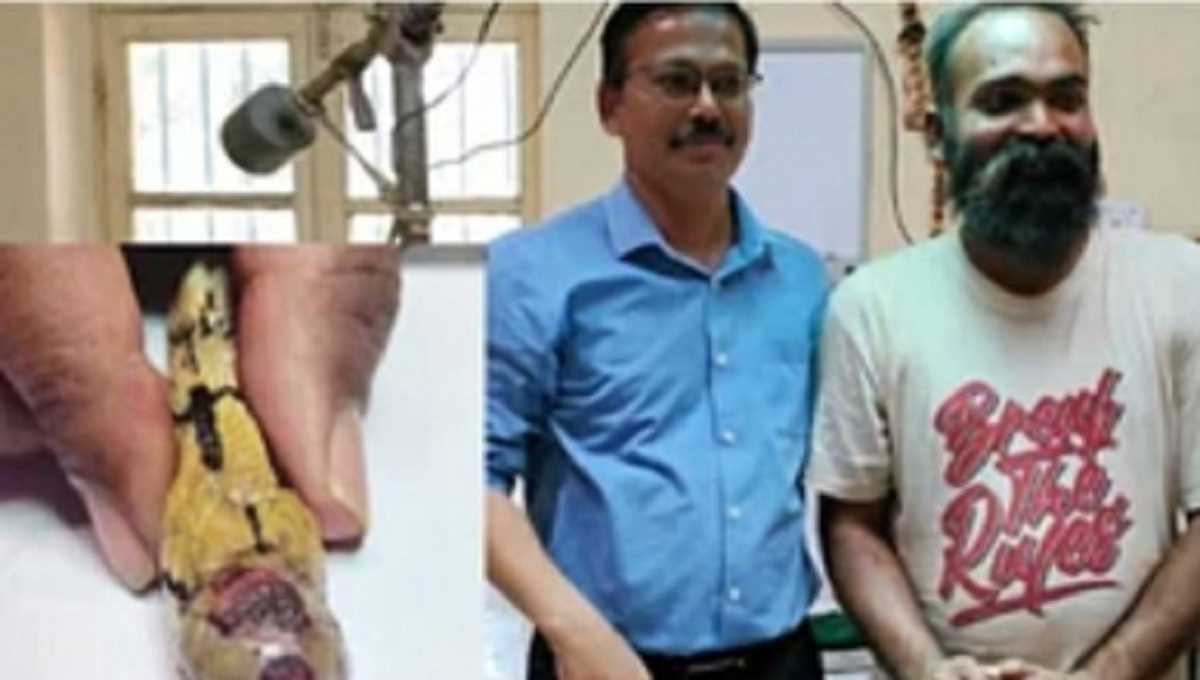 कर्नाटक : सांप की हुई सर्जरी, निकाला गया ट्यूमर