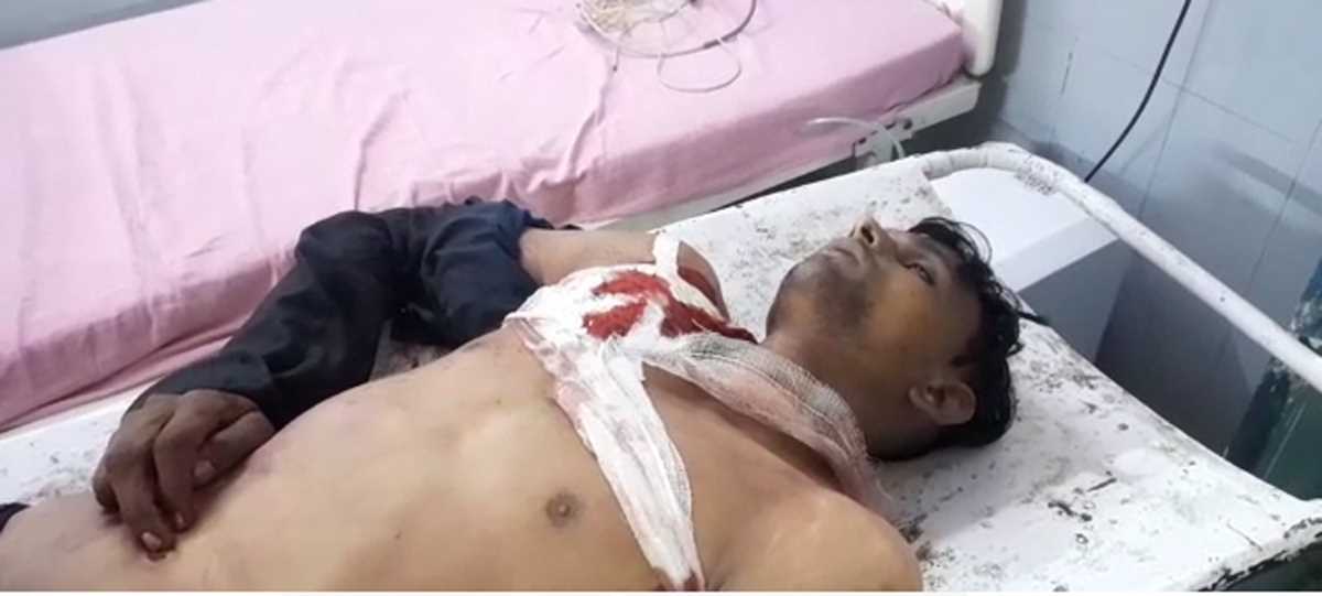 बाइक सवार 3 हमलावरों ने युवक को मारी गोली
