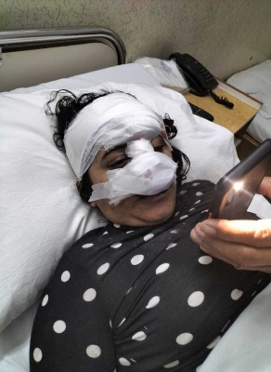 नोएडा में लुटेरों के हौसले बुलंद, लूटपाट का विरोध करने पर चलती बाइक से युवती को दिया धक्का