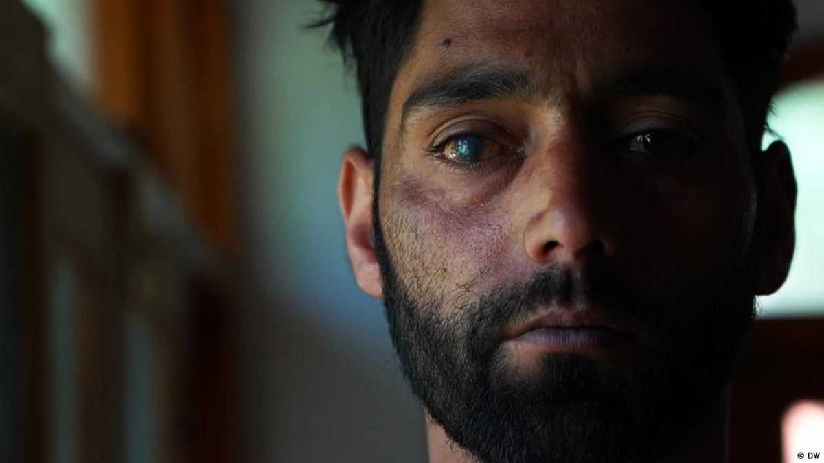 रबर की गोलियां ले रही हैं लोगों की जानेंः एमनेस्टी