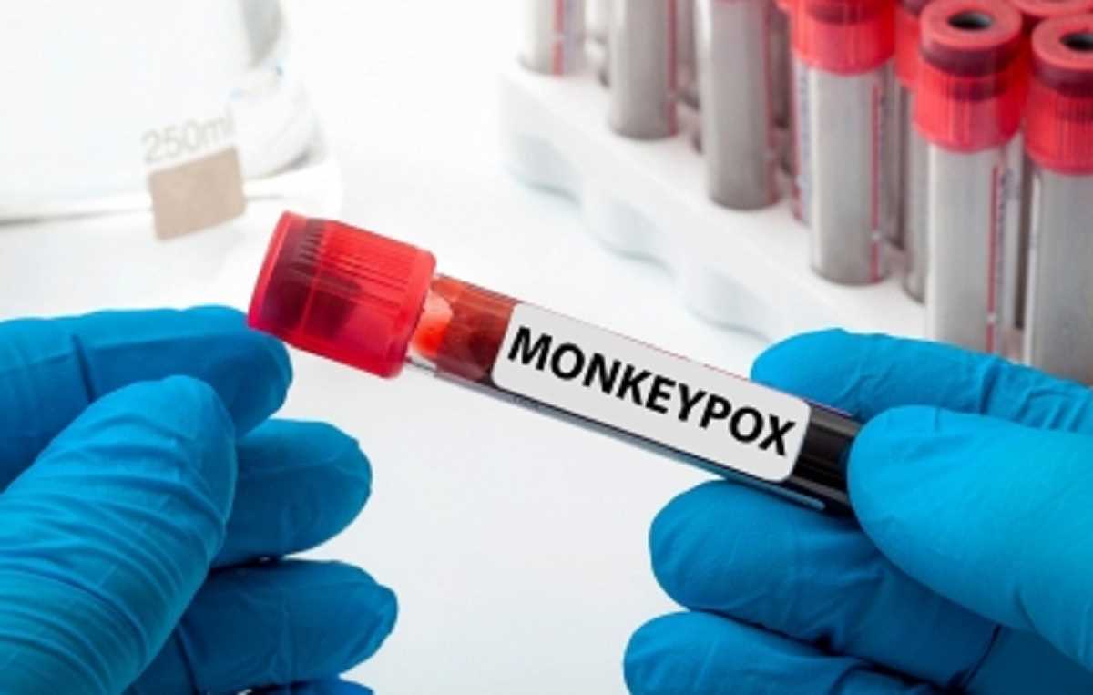 कनाडा में मंकीपॉक्स के 1,321 मामलों की पुष्टि