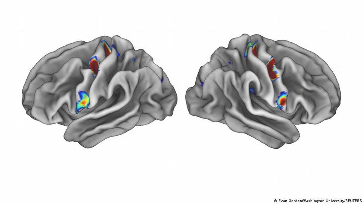 दिमाग और शरीर के बीच रिश्ता ढूंढा वैज्ञानिकों ने