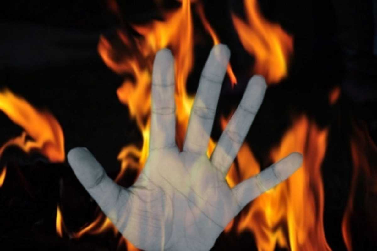 जयपुर के शंकर विहार इलाके में पुजारी ने खुद को लगाई आग, अस्पताल में भर्ती