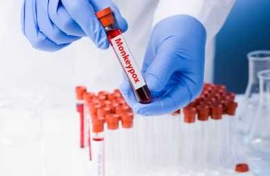 जापान में, मंकीपॉक्स को रोकने के लिए लगाए जाएंगे चेचक के टीके