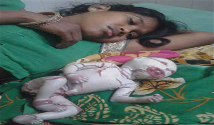 उप्र: बहराइच में अजीबोगरीब बालिका का जन्म