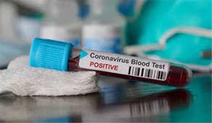 इजरायली स्वास्थ्य मंत्री लित्ज़मैन पत्नी समेत कोरोना से संक्रमित