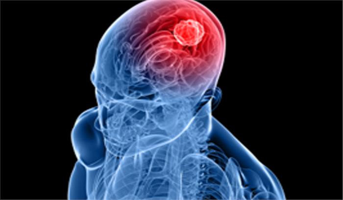 ब्रेन ट्यूमर पीड़िता को मिला नया जीवन