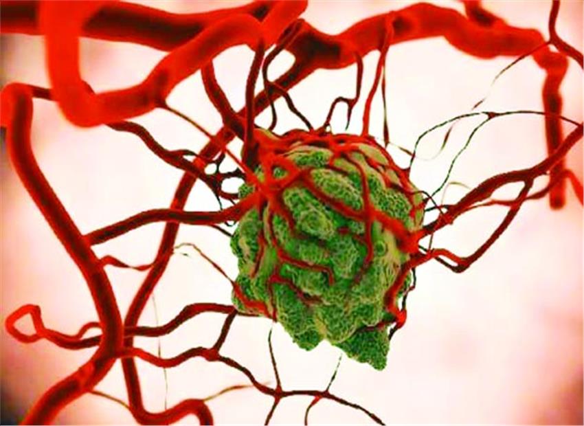 कैंसर की रोकथाम के लिये विशेष अभियान शुरू