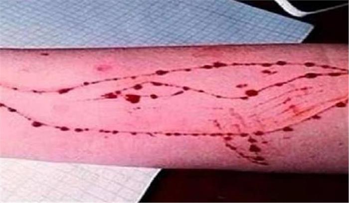  किशोर ने की आत्महत्या, ब्लू व्हेल पर संदेह