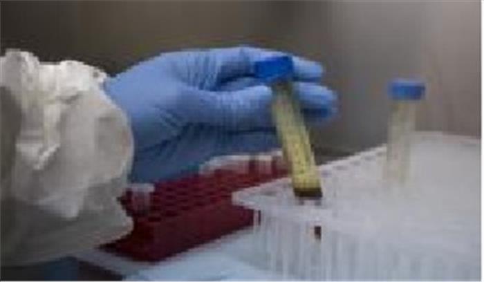 चंडीगढ़ में कोरोना वायरस का संदिग्ध मामला