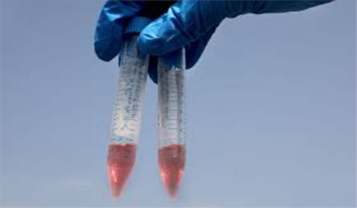 कोरोना टेस्ट में गड़बड़ी का दावा, 2 कर्मचारियों की सेवाएं समाप्त कोरोना टेस्ट में गड़बड़ी का दावा, 2 कर्मचारियों की सेवाएं समाप्त