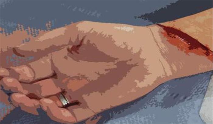 नाचने के दौरान हुआ विवाद, युवक ने काट डाली कलाई