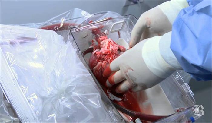 दिल्ली के 56 वर्षीय व्यक्ति में धड़का जयपुर के युवक का दिल