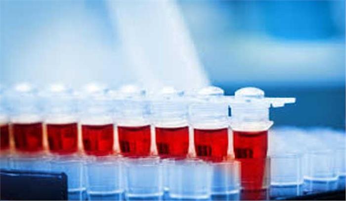 कोरोना के लिए सबका ‘सीरम टेस्ट’ जरूर हो: विशेषज्ञ कोरोना के लिए सबका ‘सीरम टेस्ट’ जरूर हो: विशेषज्ञ