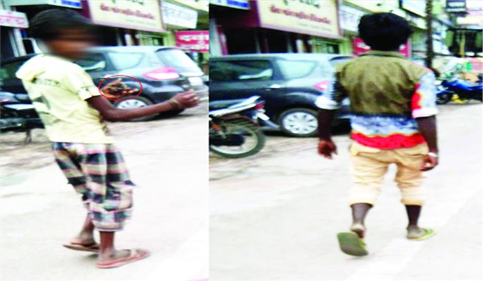 बच्चों-किशोरों में तेजी से बढ़ रही नशा करने की प्रवृत्ति