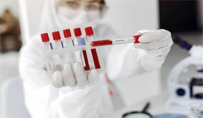 गोरखपुर और मेरठ मेडिकल कालेज में होंगे कोरोना टेस्ट