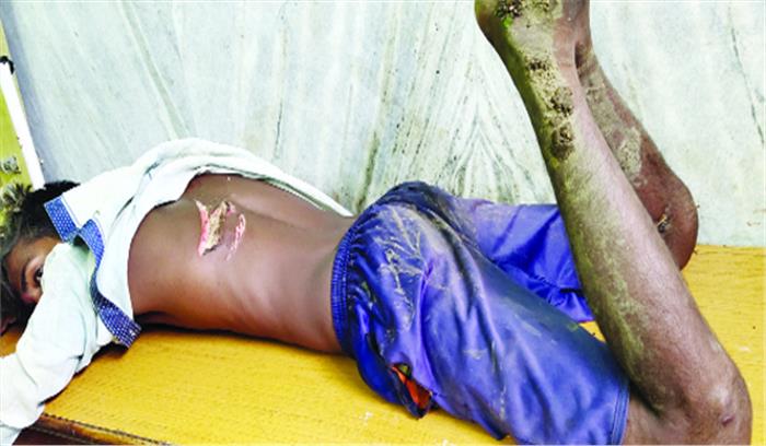 गरियाबंद में करंट से युवक घायल जिला अस्पताल में भर्ती गरियाबंद में करंट से युवक घायल जिला अस्पताल में भर्ती