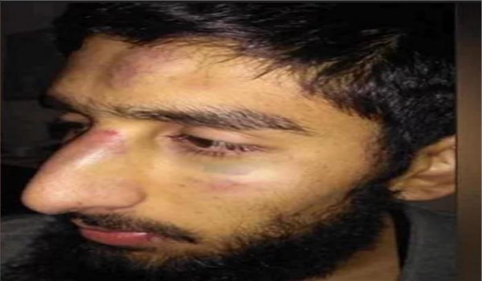 हरियाणा: 2 कश्मीरी छात्रों पर हमला, मामला दर्ज