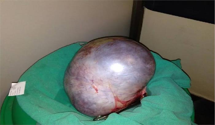 महिला के पेट से सात किलो का निकला ट्यूमर