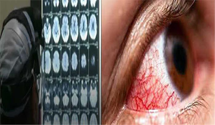 हिमाचल प्रदेश में ब्लैक फंगस एक साल के लिए महामारी घोषित