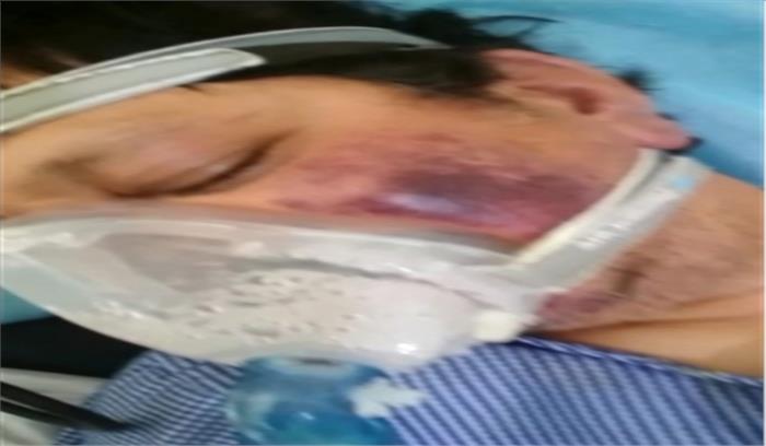 जम्मू-कश्मीर में ब्लैक फंगस से हुई पहली मौत जम्मू-कश्मीर में ब्लैक फंगस से हुई पहली मौत