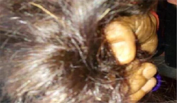 चोटी काटने वाले अपराधियों को पकड़ने पर 6 लाख का इनाम