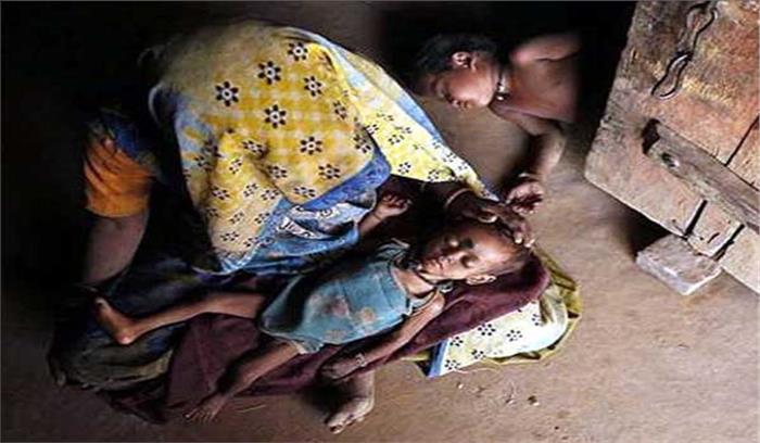मप्र में कुपोषण से रोज 92 बच्चों की हो रही मौत  : आप