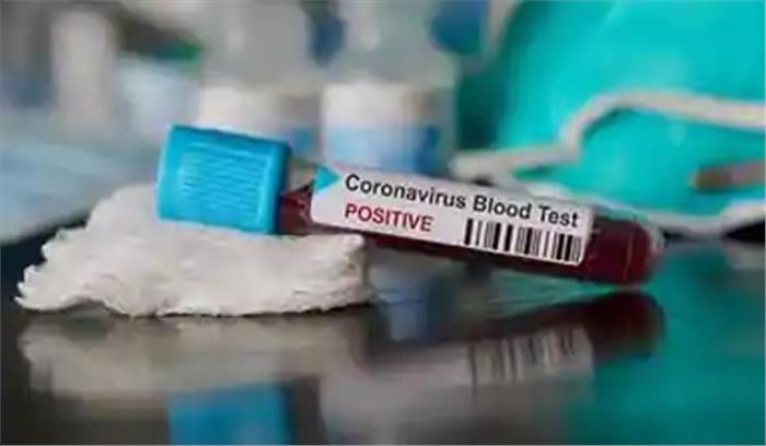 मप्र में कोरोना के 192 नए मामले, अब तक 431 मौतें मप्र में कोरोना के 192 नए मामले, अब तक 431 मौतें