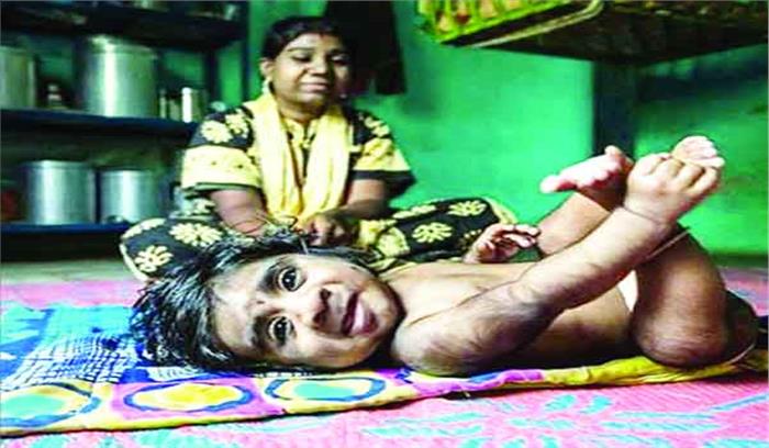 कुपोषण से लड़ने के लिए सरकार कर रही है तैयारी