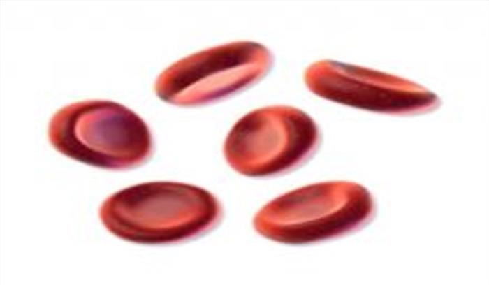 देश में 57 प्रतिशत महिलाएं एनीमिक- महिला एवं बाल विकास मंत्रालय