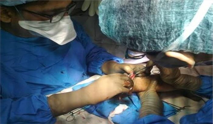 पंजाब में पुलिस अधिकारी का कटा हाथ फिर से जोड़ा गया