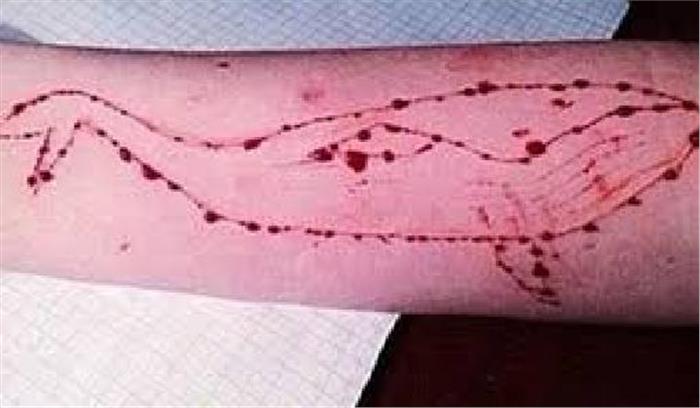 9वी कक्षा का छात्र ब्लू व्हेल गेम में  तीसरी स्टेज पर पहुंचा