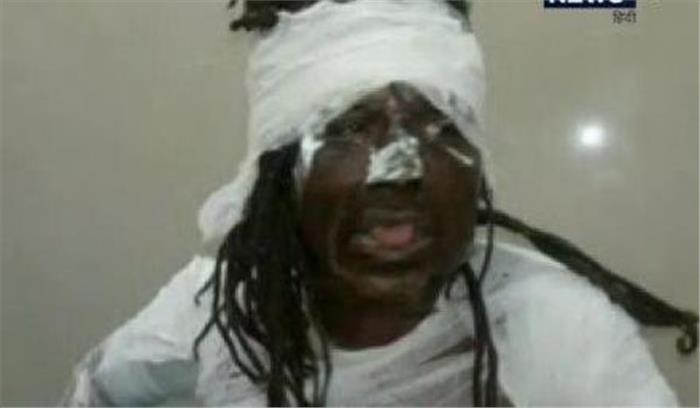 रामजन्म भूमि थाने में खुद को आग लगाने वाले साधु की मौत