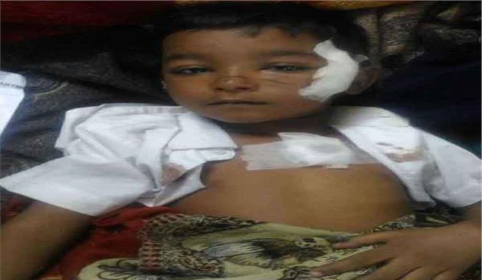 लखनऊ में घायल छात्र को देखने पहुंचे CM योगी, स्कूल की प्रिंसिपल गिरफ्तार