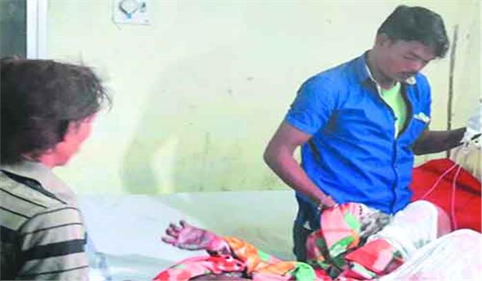 छात्र को पेट्रोल डालकर जलाया छात्र को पेट्रोल डालकर जलाया