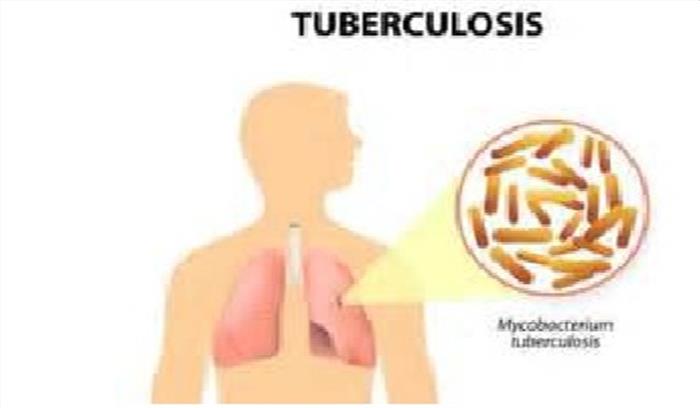 क्षय रोग के खात्मे के लिए योजनाबद्ध तरीके से काम शुरू