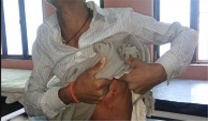 ताऊ ने भतीजे को मारा चाकू, गंभीर