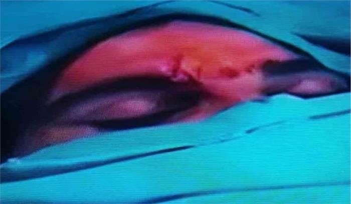 मोहम्मद शमी सड़क दुर्घटना में घायल, सिर पर आए टांके मोहम्मद शमी सड़क दुर्घटना में घायल, सिर पर आए टांके