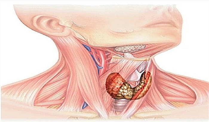 थायराइड हार्मोन के असंतुलन से जुड़ा है (संशोधित)
