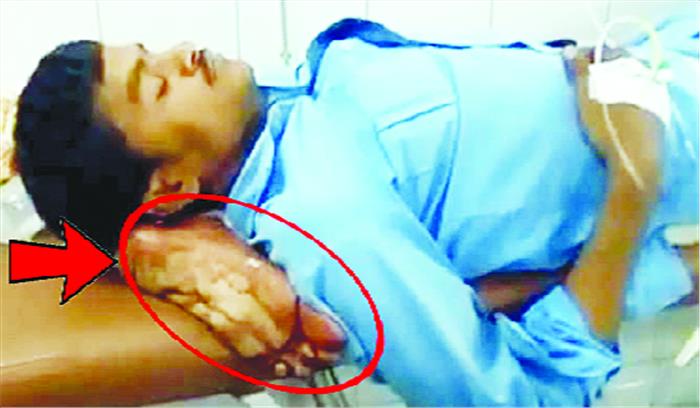 चिकित्सकों ने मरीज के कटे पैर को बनाया तकिया