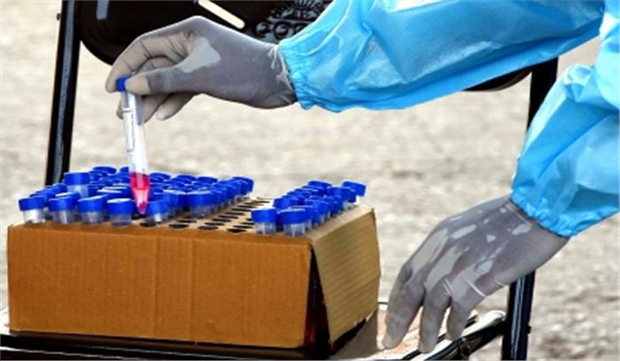 यूपी में हर रोज 10 गुना ज्यादा टेस्ट हो रहे