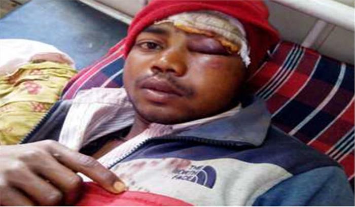 पथरीला मलबा गिरने से युवक गंभीर