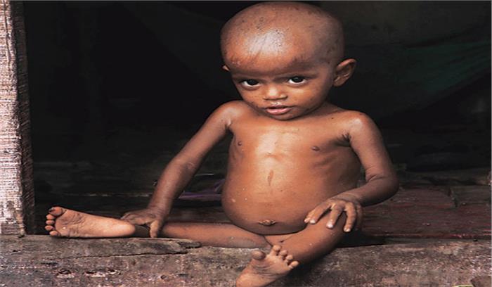 उत्तर प्रदेश में कुपोषण ने बजाई सरकार के लिए खतरे की घंटी