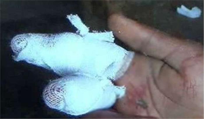 बच्चों की लड़ाई में व्यक्ति ने महिला की उंगली काटी