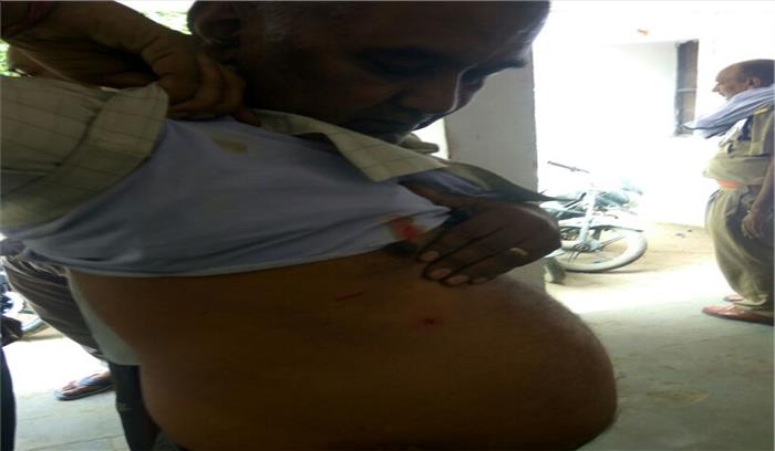 नाली के विवाद, दो पक्षों में चली कैची, तीन घायल 