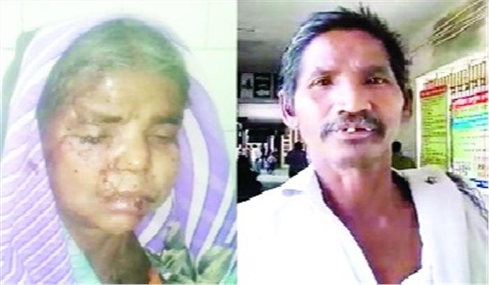 पत्नी पर भालू ने किया हमला, पति ने बचाया 