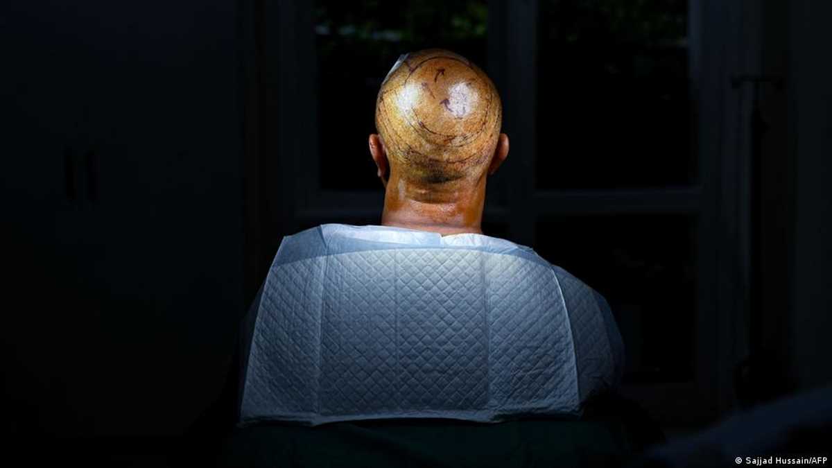 सूअर के लिवर को इंसान जैसा बनाने की कोशिश